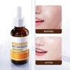 Niacinamide Whitening Serum (2 Pieces, Kangyanghuajh)