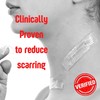 SilverSeal Burn and Wound Dressing | Hydrogel Pads with X-Static