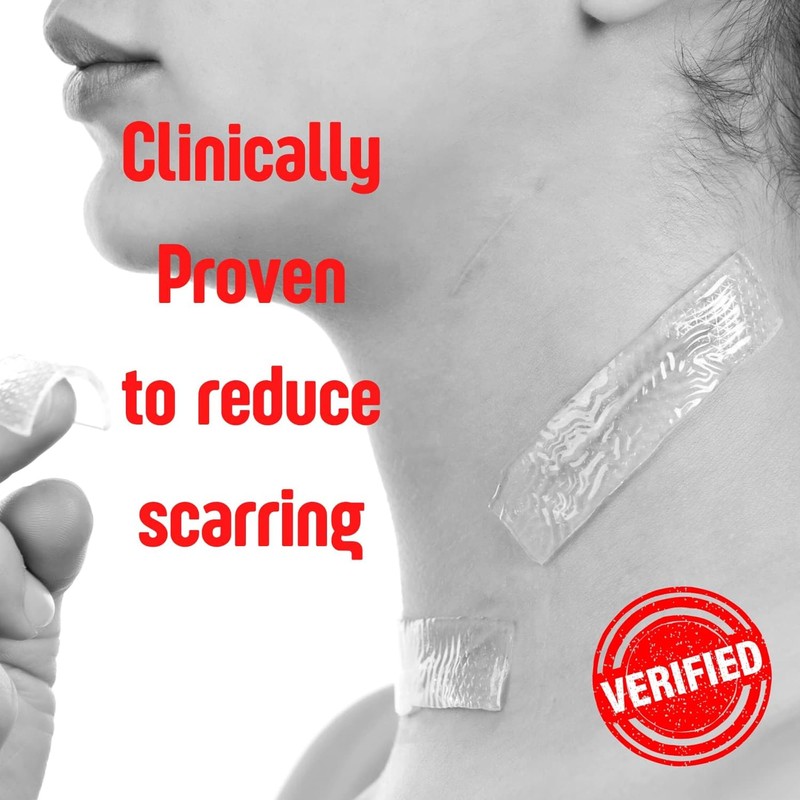 SilverSeal Burn and Wound Dressing | Hydrogel Pads with X-Static