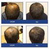 FOLIGAIN Stimulating Shampoo for Thinning Hair For Men with 2