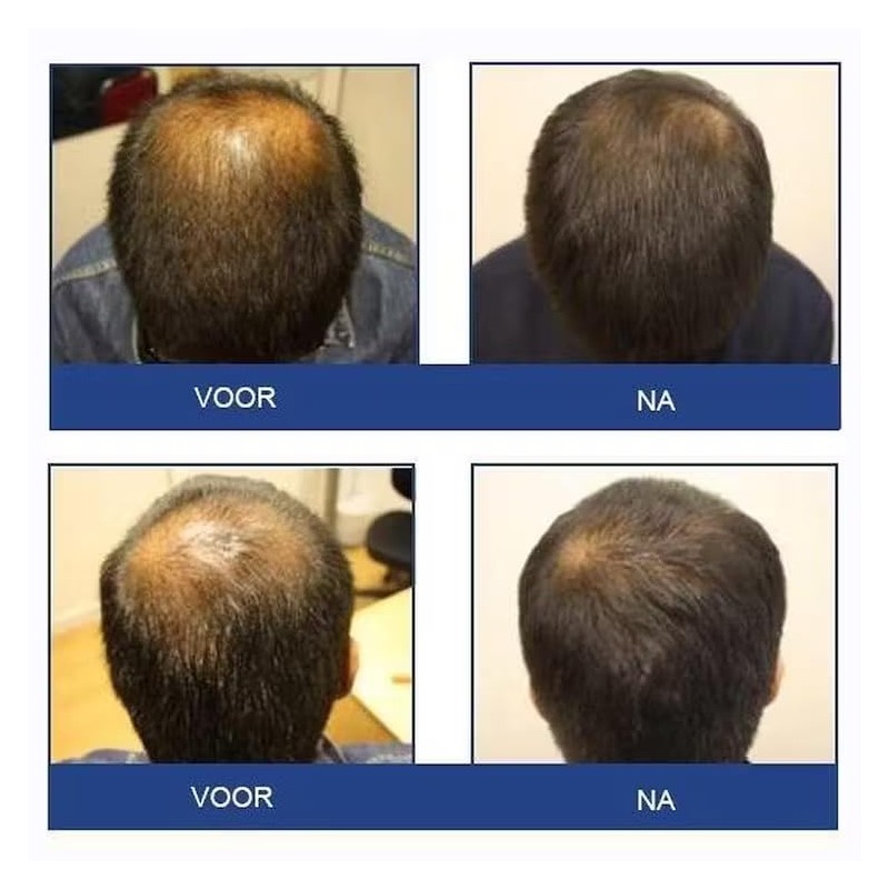 FOLIGAIN Stimulating Shampoo for Thinning Hair For Men with 2