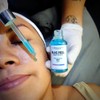 Peeling AHA 30% + BHA 2% Blue Peel Combate manchas