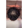 Volosy 5 Pack Fibras De Cabello Para Disimular Calvicie 28g