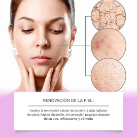 Crema Ácido Azelaico Mopoyat Acné Rostro Hipoalergénica 20ml
