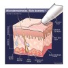 Cristales de microdermabrasión 4 lb. / 1,8 kg. Exfoliante facial