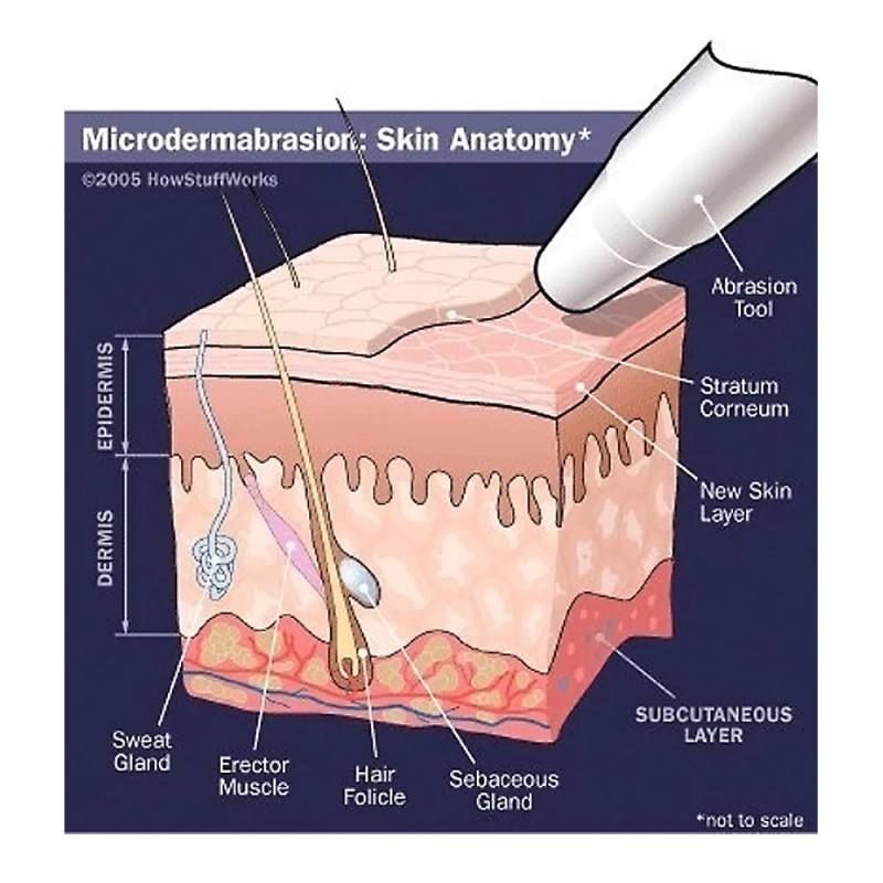 Cristales de microdermabrasión 4 lb. / 1,8 kg. Exfoliante facial