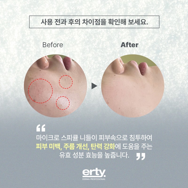Erti Perfect Spicule Formulation 20ml Spicule Formulation Cream 20ml +