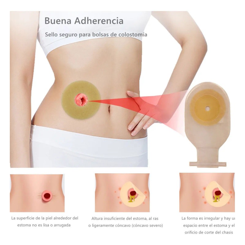 Anillo Barrera Para Ostomía 50mm 10pzas