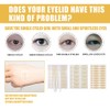 Pack of 480 Double Eyelid Tape, Slip Lid Stripes, Slip-On