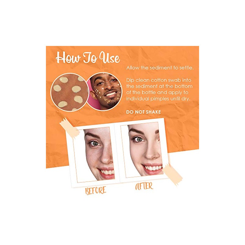 Bye Bye Blemish Dark Spot Lotion Vitamina C, 1 onza