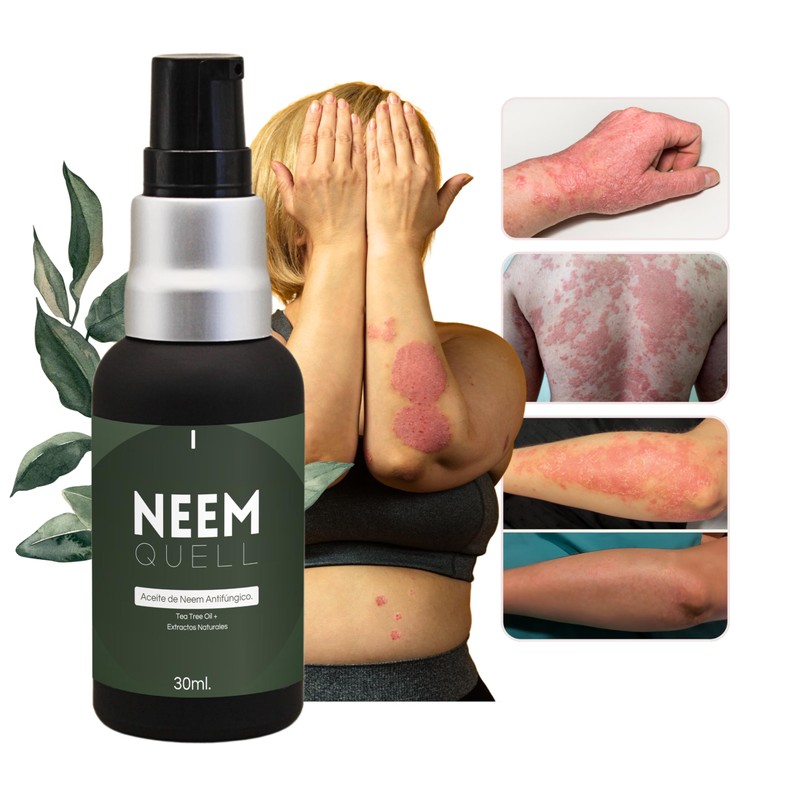 Neem Quell 30ml. - Aceite de Neem Puro 100% Natural