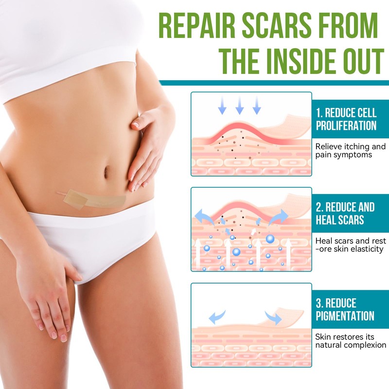 Silikonband für Narben, 300 cm, wiederverwendbar und waschbar, hautfarben