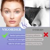 Vigorder Nose Pore Patches, Hydrocolloid Nose Patches, Targets Pimple, Pores