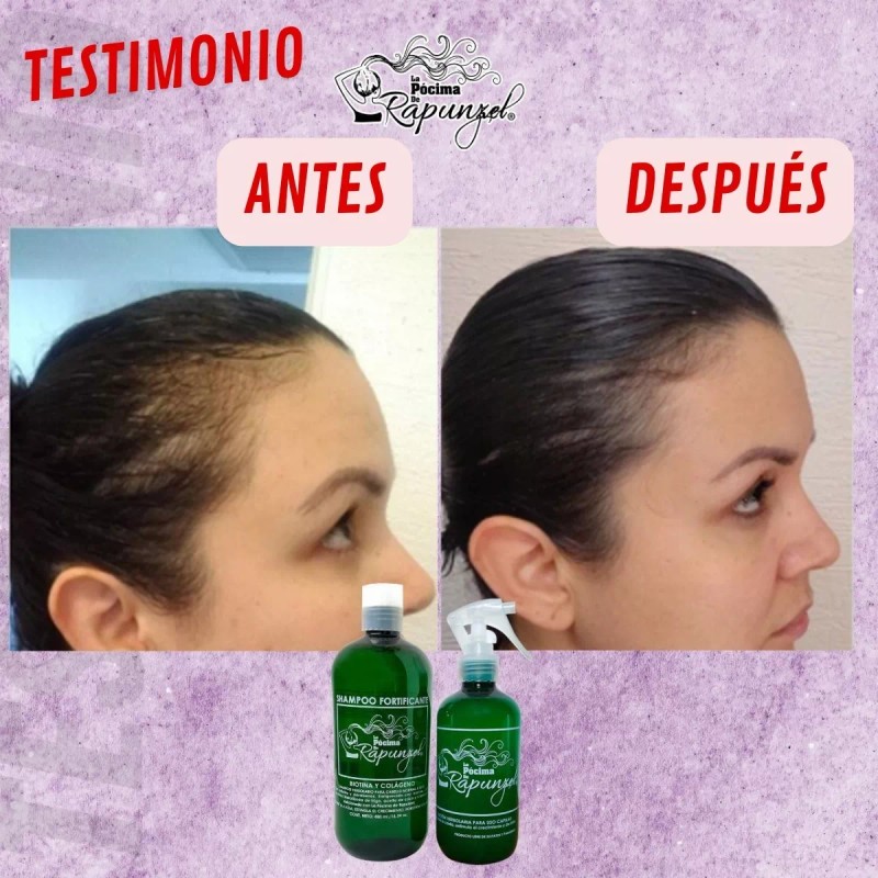 Pócima de Rapunzel. Artesanal y orgánico Kit Shampoo Fortificante Anticaída