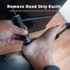 Upgraded Electric Callus Remover for Smooth Feet