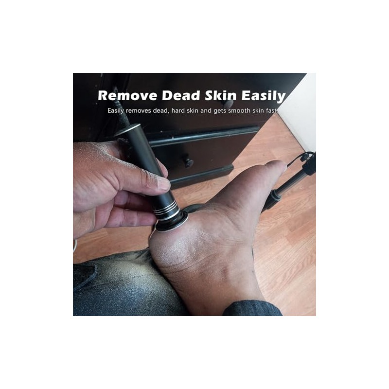 Upgraded Electric Callus Remover for Smooth Feet