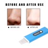 Ultrasonic Skin Scrubber Blackhead Removal Adjustable Face Pore Cleaner Beauty