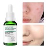 Gc Sérum Facial Reductor Poros Acido Salicílico Anti Acné
