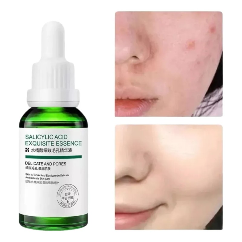 Gc Sérum Facial Reductor Poros Acido Salicílico Anti Acné
