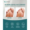 Hydrogen Foot Soak Effervescent Tablets 3 Pack | Ginger &