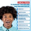 *gel Oral Gingigel Teen, 10 Unidades, Ácido Hialurónico, 15