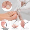 Long Steel Nail File for Onychomycosis, Double-Sided Toenail Lifter, Corner