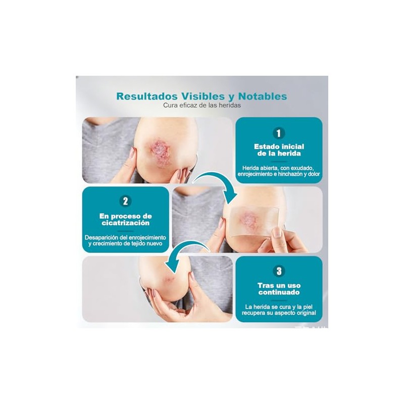Cinta Hydrocolloid Roll 1.5m x 2PCS, Vendajes de Parches Hidrocoloides