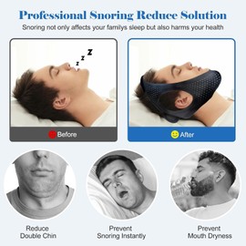 Anti Snoring Chin Strap,Stop Snoring Solution,Comfortable Sleep Apnea Devices Chin Strap,Adjustable Stop Snoring Device -AA2