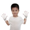 Edenswear Zinc-containing Fiber Children Eczema Atopic Fingerless Gloves (S)