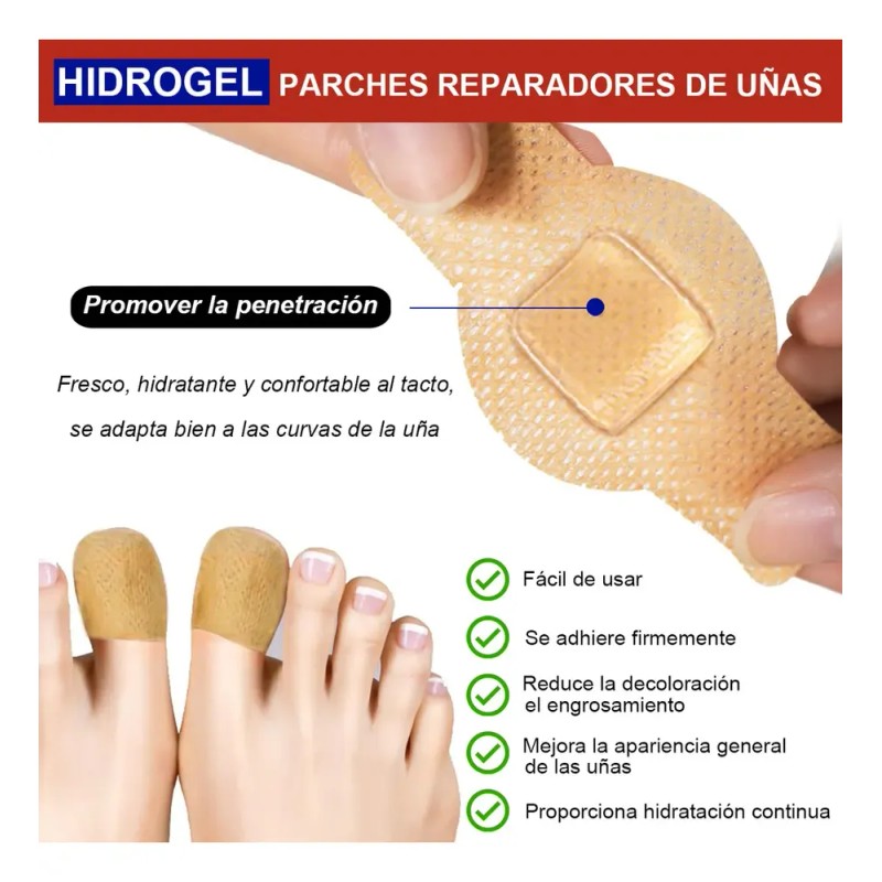 & [100 Parches Antimicóticos Para El Tratamiento De Hongos E