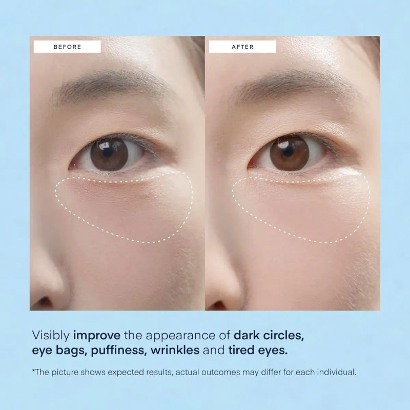 Parches Para Ojeras Debajo De Los Ojos, 60 Máscaras Coreanas