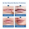 Protector Labial Reparador Labial Labios Secos Y Pelados 20g