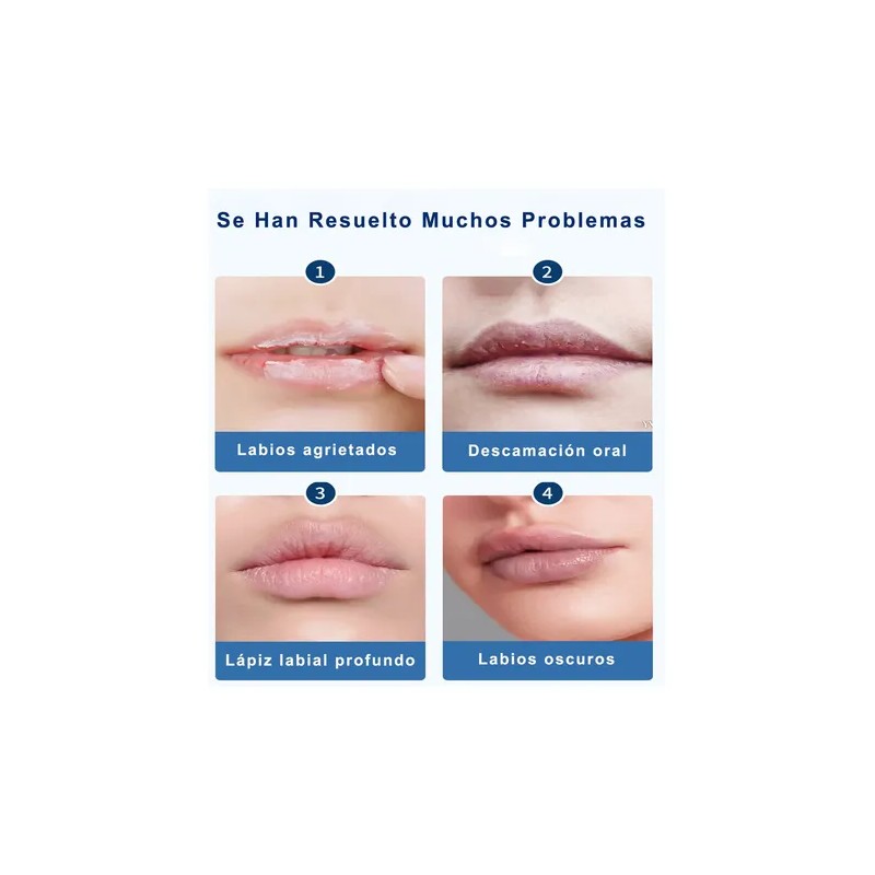 Protector Labial Reparador Labial Labios Secos Y Pelados 20g