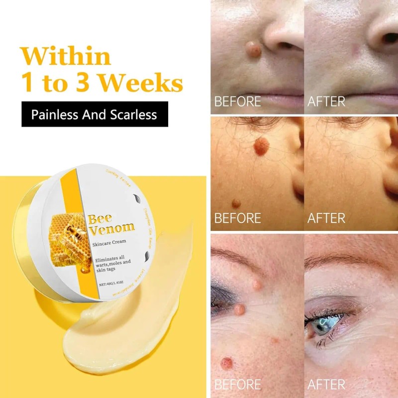 Crema De Tratamiento Para La Piel Que Reduce Las Imperfeccio