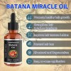 Aceite Para El Crecimiento Del Cabello Batana 60 Ml* 2
