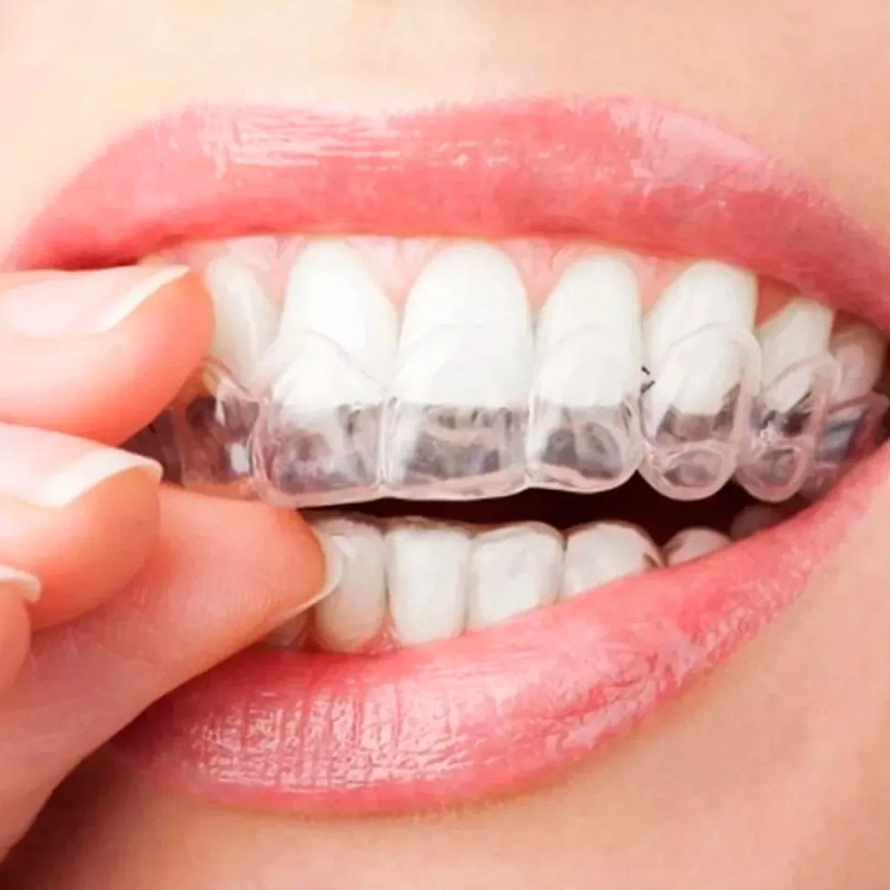 Veraly Protectores Bucales, Guardas Dentales De Gel Moldeables 2pz Color
