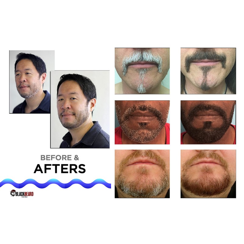 Blackbeard for Men Formula X Instant Mustache, Beard, Eyebrow and