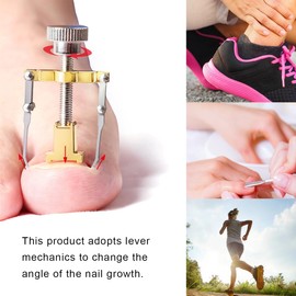 77 Pieces Ingrown Toenail Tool Set, Include Ingrown Toenail File and Lifter and 60 Pcs Ingrown Toenail Correction Stickers Ingrown Toenail Corrector Treatment Kit for Nails Health