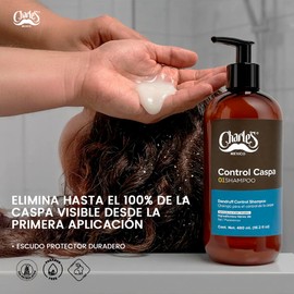 Charles Shampoo Control Caspa - Sin Sales y Parabenos - Con Extracto de Aloe Vera - Ayuda a Reducir la Caspa Visible - Ayuda a la Picazón y...        