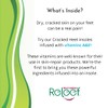 Cracked Heel Relief | Infused Insoles | Releef Direct Solutions