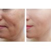 Crema Antiedad Hidratante. Aclarante.antimanchas Vitamina C Todo Tipo De Piel