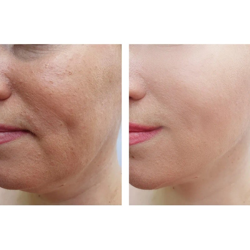 Crema Antiedad Hidratante. Aclarante.antimanchas Vitamina C Todo Tipo De Piel
