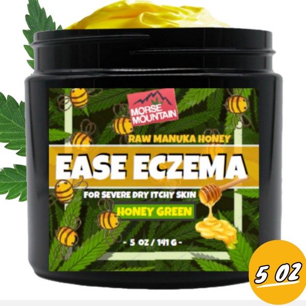 Eczema Raw Manuka Honey - Natural Healing Cream Non GMO