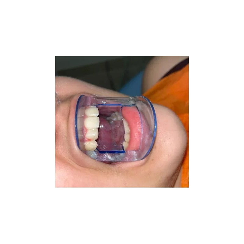 CNSEATO Retractor Separador De Carrillos Y Lengua Autoclavable 5 Pza