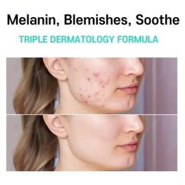 V Yyds - 2026 Pack 2 Crema Centella Asiática Ilumina B