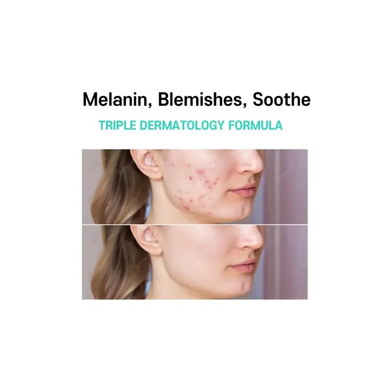V Yyds - 2026 Pack 2 Crema Centella Asiática Ilumina