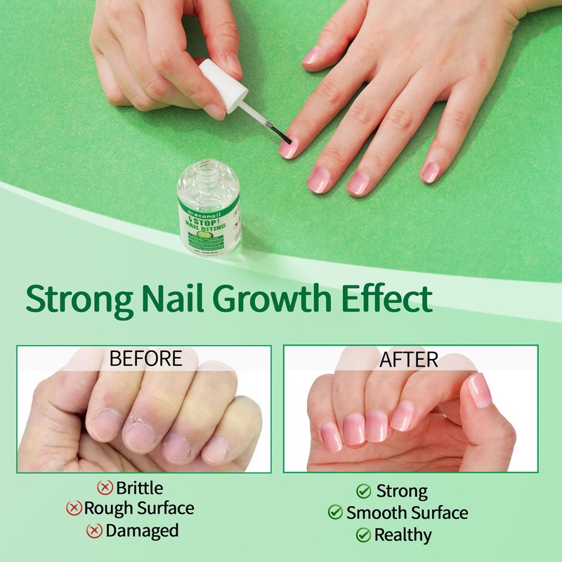 Econail Nail Biting Treatment For Kids, Nail Biting Prevention, No