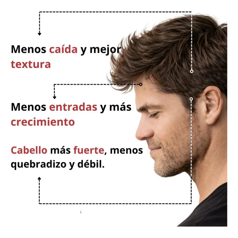 Om Style - Kit Crecimiento Capilar + Anticaída 2 Hair