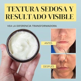 Bálsamo de Miel de Sebo de Res para Piel Sensible: 100% Orgánico Alimentado con Pasto Crema Hidratante Vintage de Sebo para Cara y Manos Agrietadas Cr
