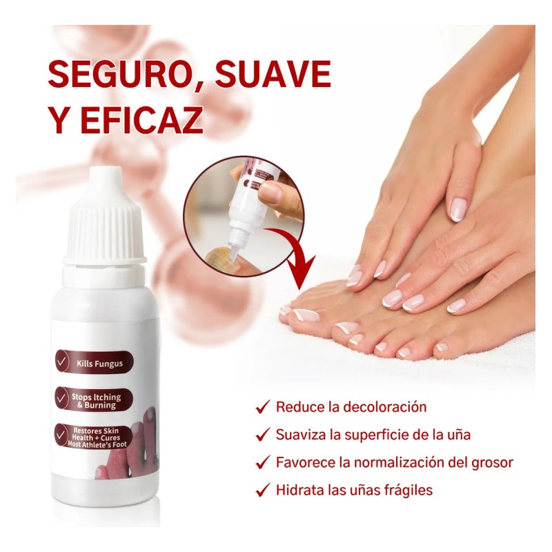 Fungicida Para Uñas Con Hongos, Amarillas,engrosadas Y Duras